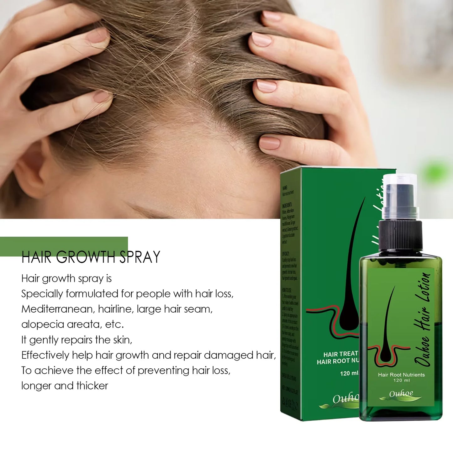 Hair Growth Spray Anti Hair Loss Treatment.